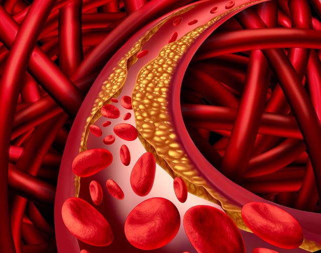 uploads/treatment_packages/1761574896_lipid.jpg